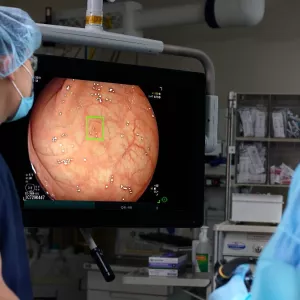 Surgeons utilize the groundbreaking GI Genius™ AI module during a colonoscopy, enhancing polyp detection by up to 50% and setting a new standard in colorectal cancer prevention and early diagnosis.