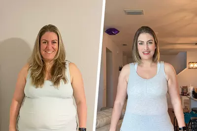 Stephanie Before and After Bariatrics