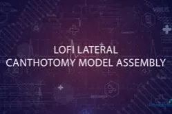 Lateral Canthotomy.mp4