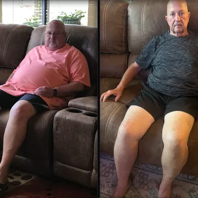 Jim’s Bariatric Surgery Journey