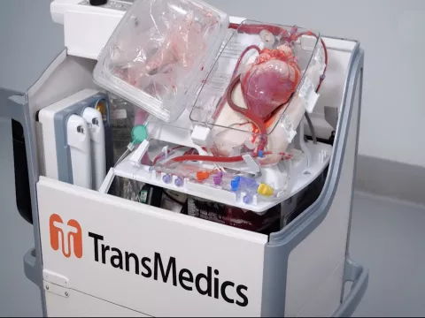 AdventHealth Transplant Institute is the first in Florida to use technology that will greatly expand the donor pool for those needing a transplant.