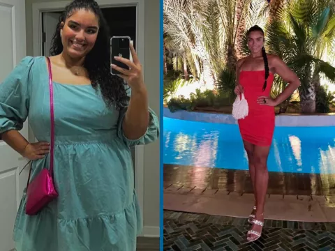 Sharlene's before and after photos showing her transformation following bariatric surgery.