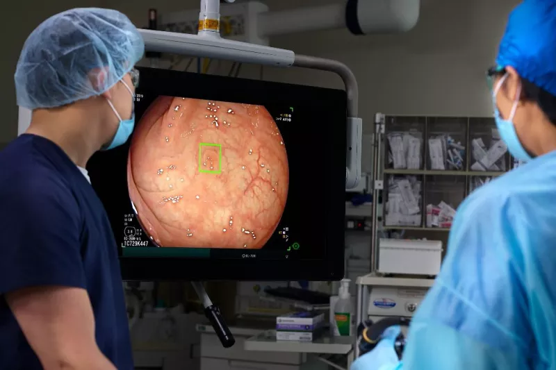 Surgeons utilize the groundbreaking GI Genius™ AI module during a colonoscopy, enhancing polyp detection by up to 50% and setting a new standard in colorectal cancer prevention and early diagnosis.