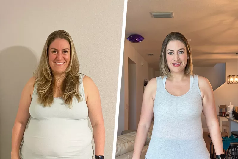 Stephanie Before and After Bariatrics