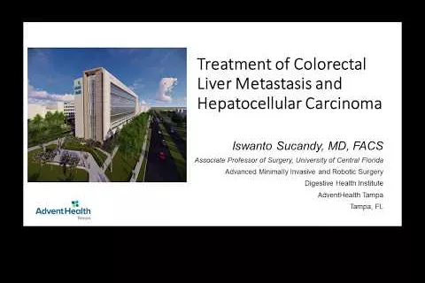 CME: Colorectal Liver Metastasis and Hepatocellular Carcinoma by Iswanto Sucandy, MD