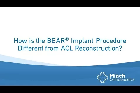 How is the BEAR Implant Procedure Different from ACLR? | Q&A | Dr. Sean Keyes | Miach Orthopaedics