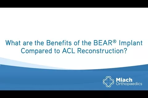 What are the Benefits of BEAR Implant Compared to ACLR? | Q&A | Dr. Sean Keyes | Miach Orthopaedics