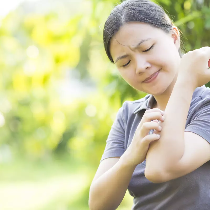 A woman scratches an itchy rash on her arm.