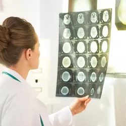A woman looks at a brain scan.