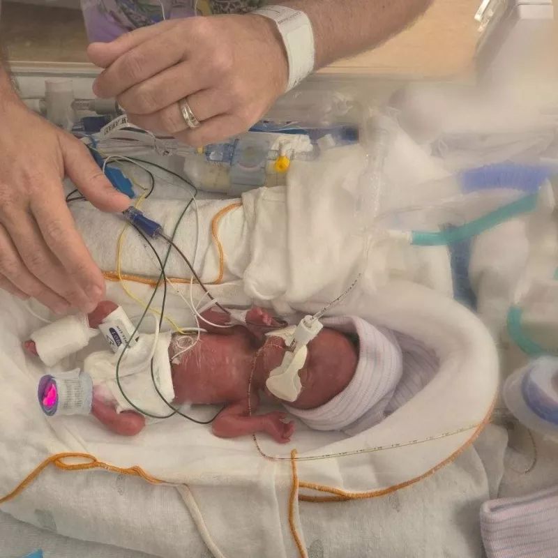 Baby Charlotte Peele, weighing less than a pound, sleeps in an incubator in the NICU. Unable to hold her, her father reaches in his hands to gently touch her.