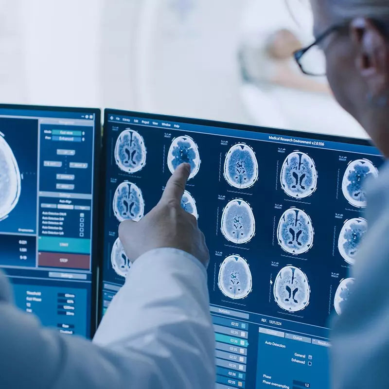 Doctors looking at a screen with brain scans