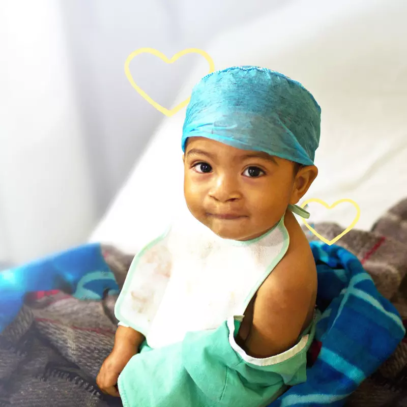 AdventHealth Sharing Smiles, cleft lip patient