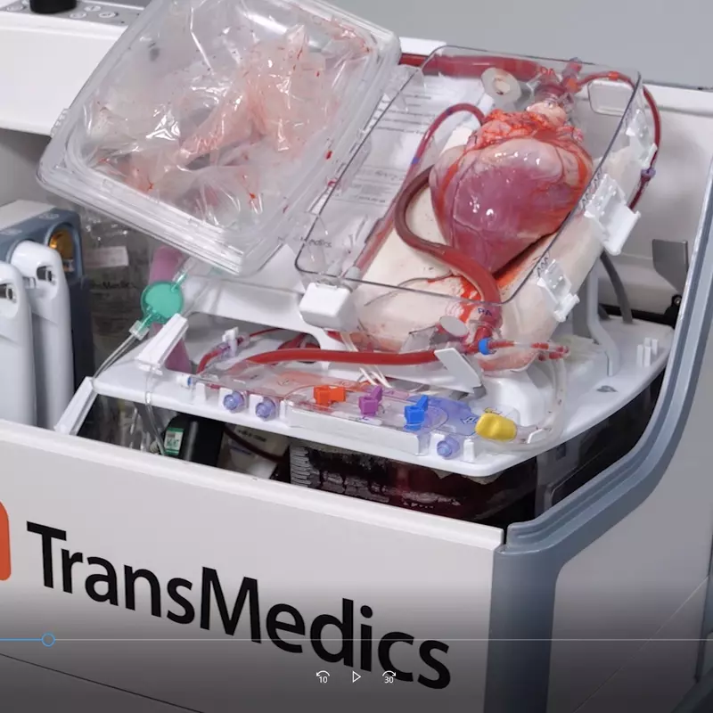 Side view of device that keeps a heart pumping after donor death