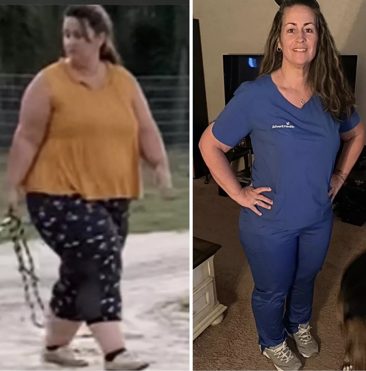 When Cianciotto felt limited by weight gain, she underwent bariatric surgery with the support of her AdventHealth team, which enabled her to return to the sport she loves.