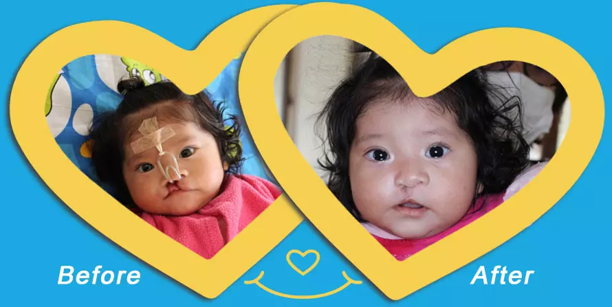 a before and after photo of baby flor
