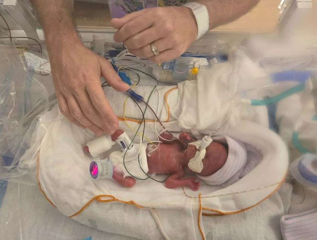 Baby Charlotte Peele, weighing less than a pound, sleeps in an incubator in the NICU. Unable to hold her, her father reaches in his hands to gently touch her.