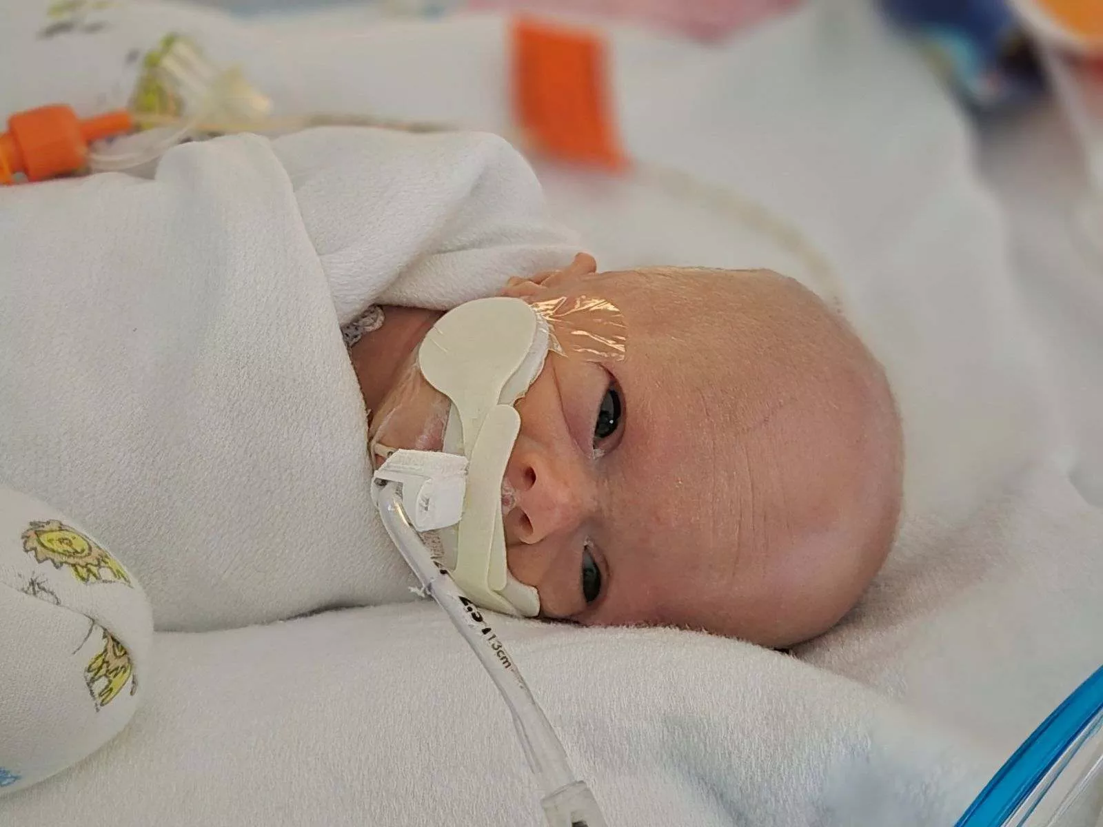 Baby Charlotte Peele swaddled in a blanket and hooked up to a ventilator in the NICU.