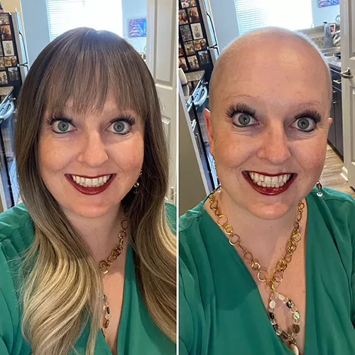 Jackie with and without wig during chemo